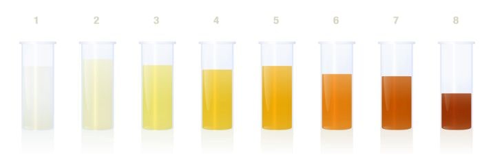 urine colors